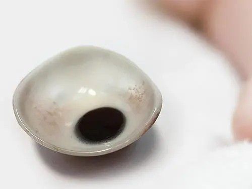 韶關(guān)南雄義眼