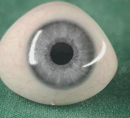 韶關(guān)南雄假眼
